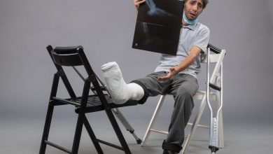 front view young male sitting with broken foot and holding x ray of it on grey floor twist pain leg broken male accident foot
