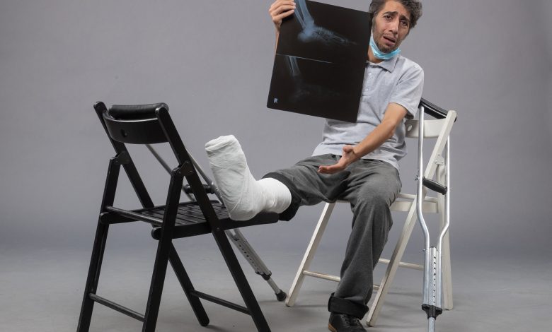 front view young male sitting with broken foot and holding x ray of it on grey floor twist pain leg broken male accident foot